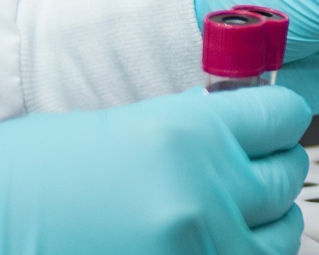 Diagnosing lupus blood samples