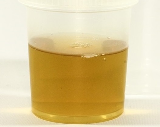 urine sample