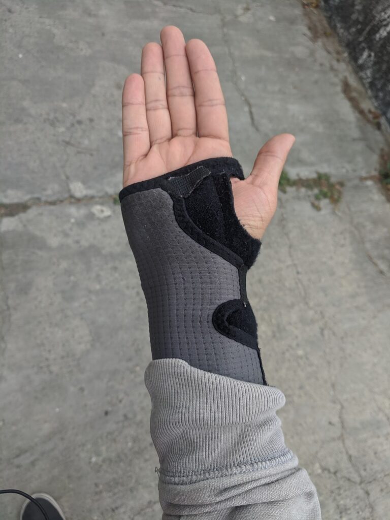 wrist brace for joint protection for the wrist with lupus arthritis